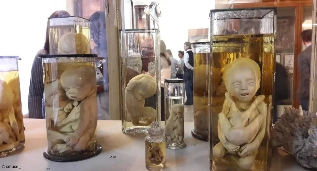 Rusya’nın karanlık yüzü mü yoksa bilimin zaferi mi? Büyük Petro tarafından kurulan Kunstkamera müzesi, anomalili bebek koleksiyonu ve şaşırtıcı hikayesiyle haberimizde.