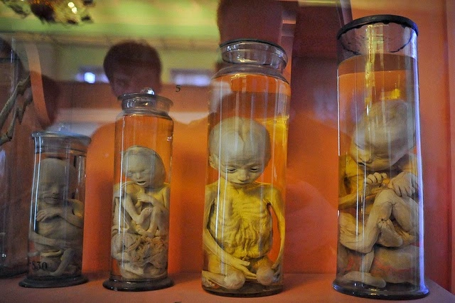 Rusya’nın karanlık yüzü mü yoksa bilimin zaferi mi? Büyük Petro tarafından kurulan Kunstkamera müzesi, anomalili bebek koleksiyonu ve şaşırtıcı hikayesiyle haberimizde.