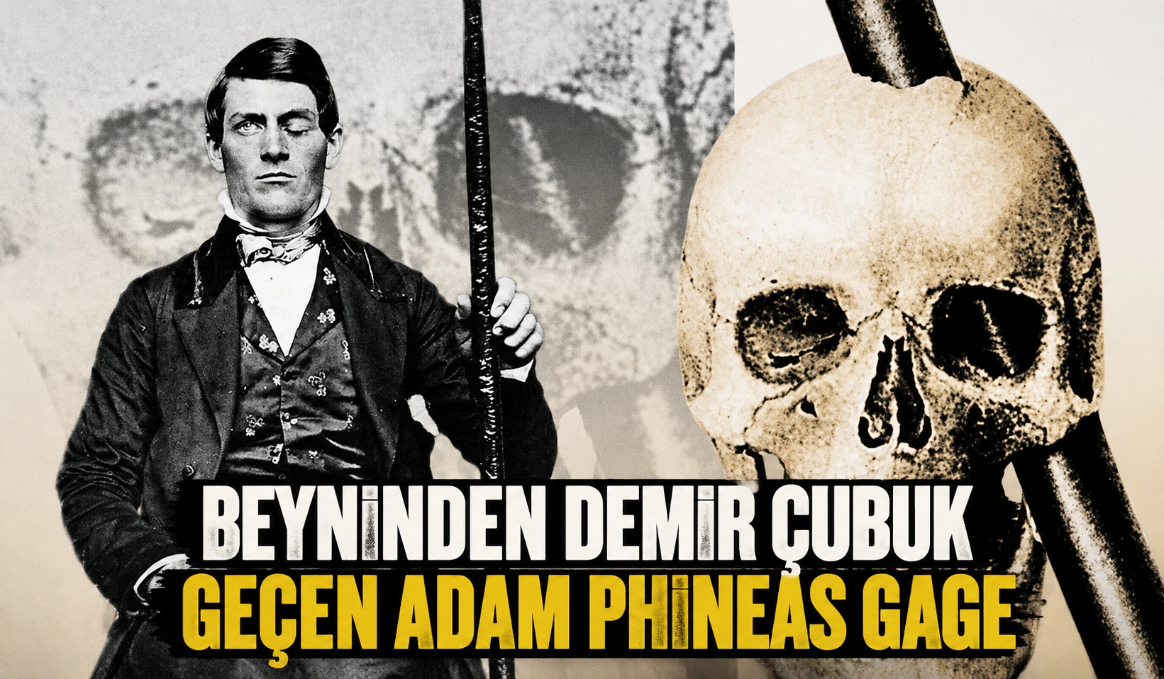 Beyninden Demir Çubuk Geçen Adam Phineas Gage