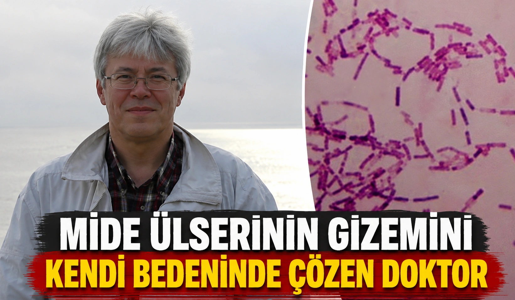 Mide Ülserinin Gizemini Kendi Bedeninde Çözen Doktor