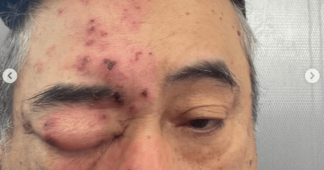 Yüzünü Kemiren Fareyle Uyandı: Dehşet Anı